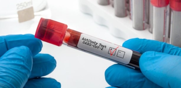 5524 са новите случаи на коронавирус у нас при направени